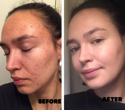 AMORA® Eye Balm Stick