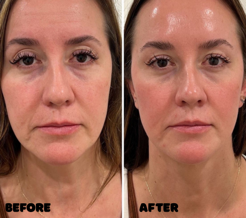 AMORA® Eye Balm Stick