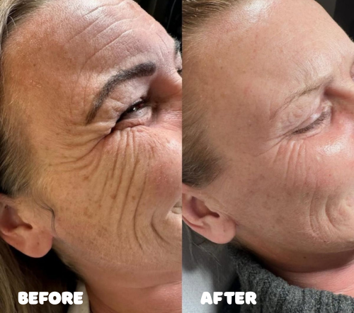 AMORA® Eye Balm Stick